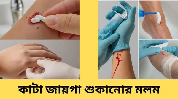 kata jaiga sukanor upay bangla